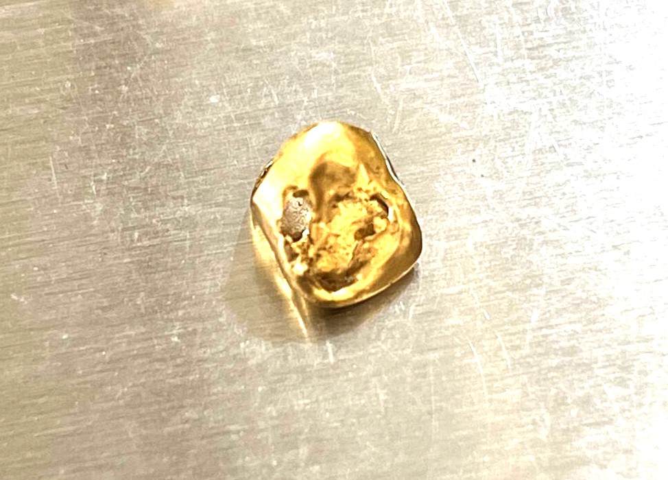 金歯 金冠 K18 歯科治療