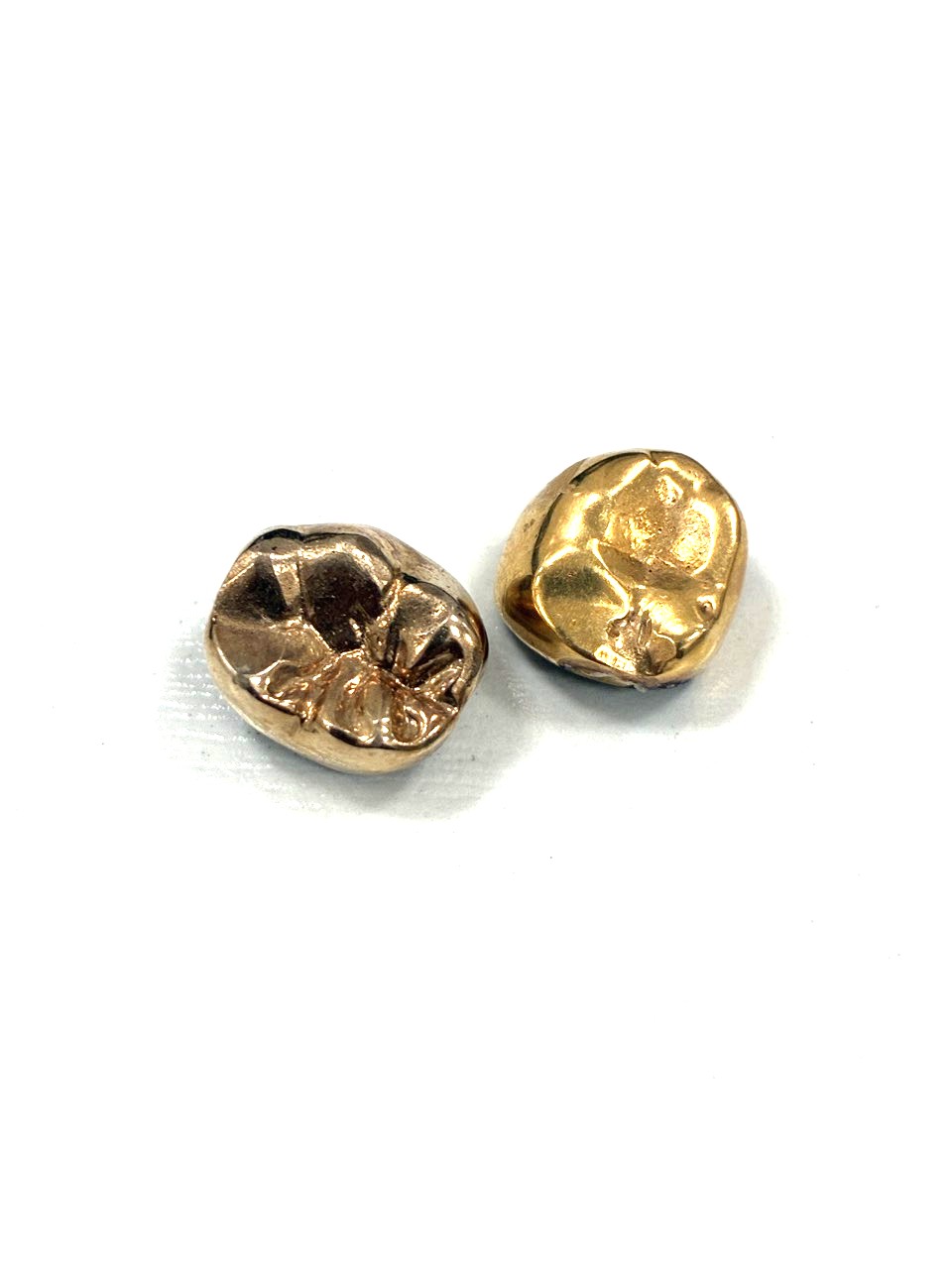 金歯