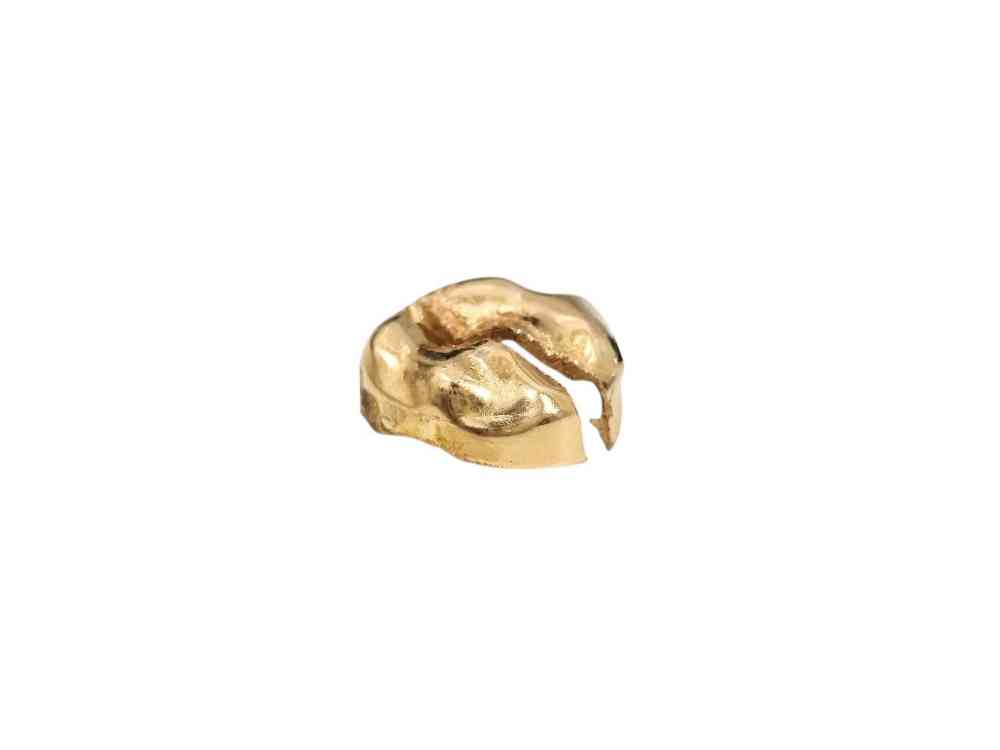 金歯