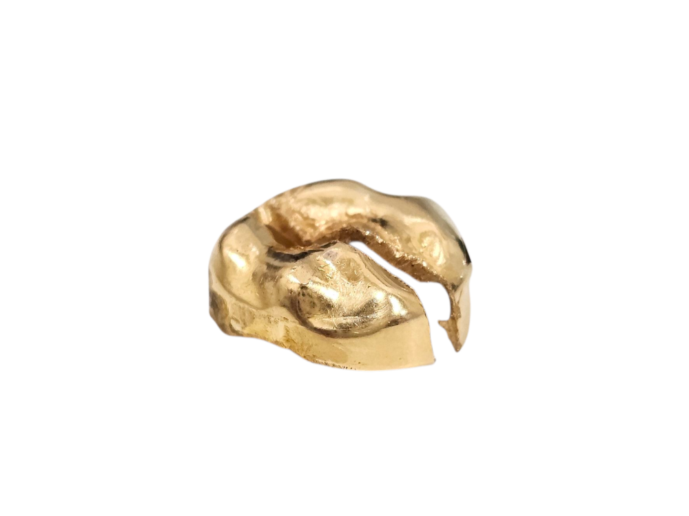 金歯