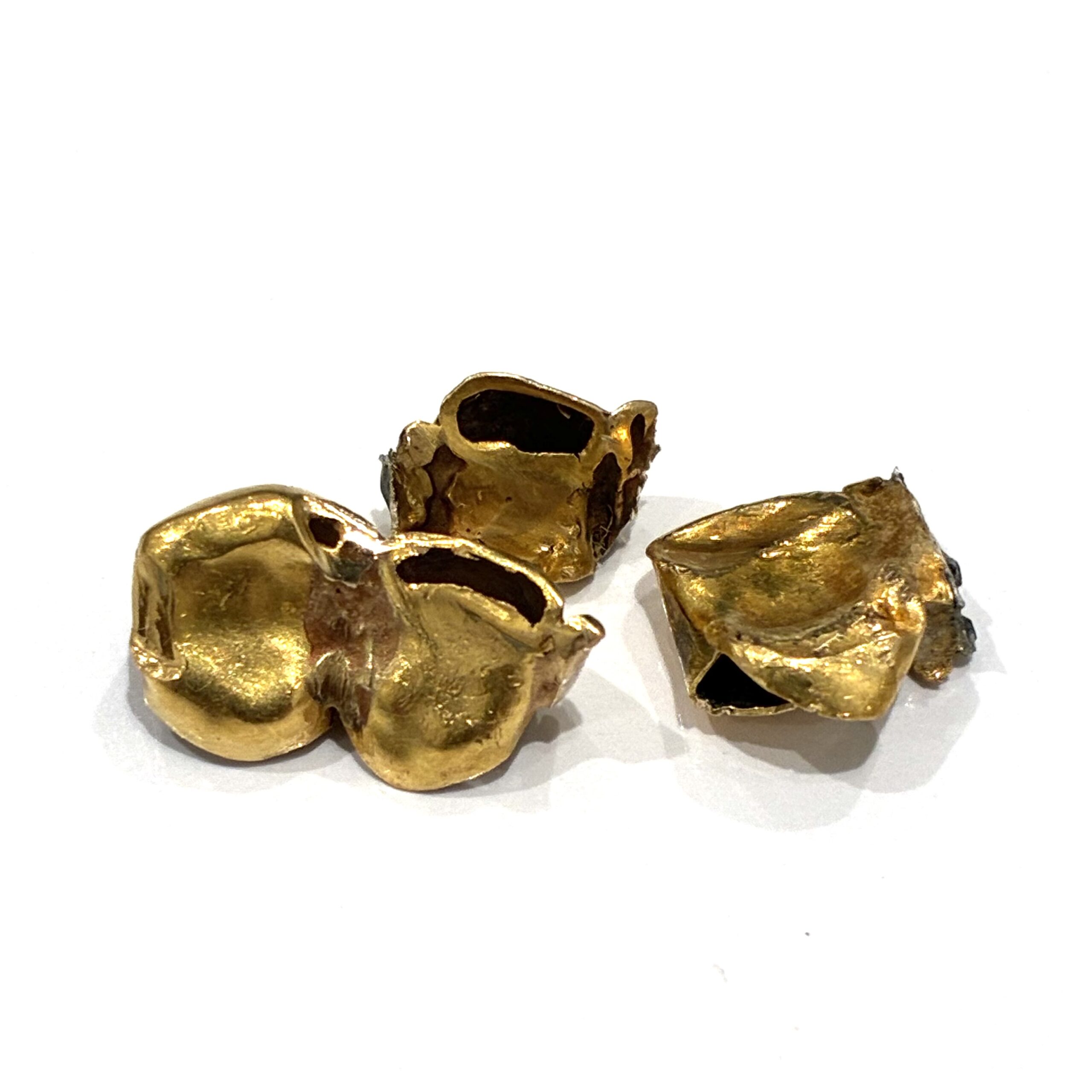 金歯 金 金相場 高騰 買取 高価買取 歯