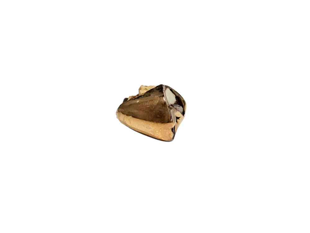 金歯