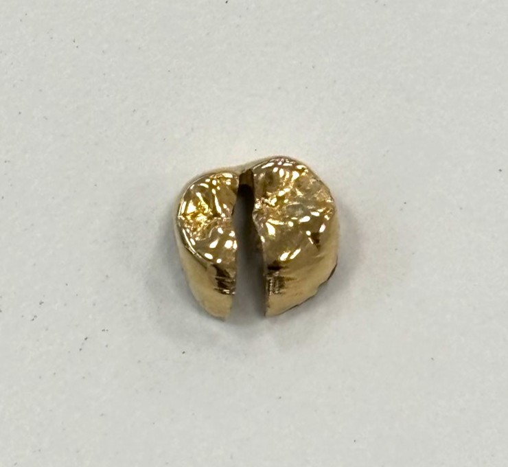 金歯