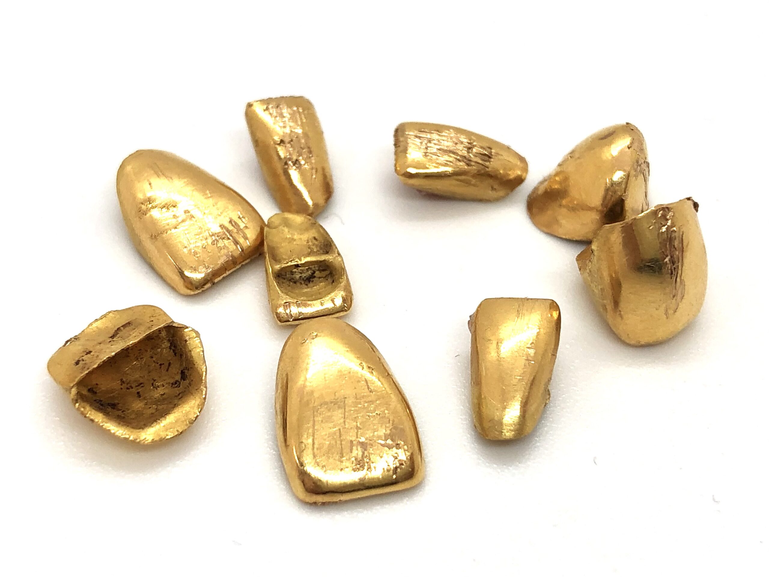 金歯